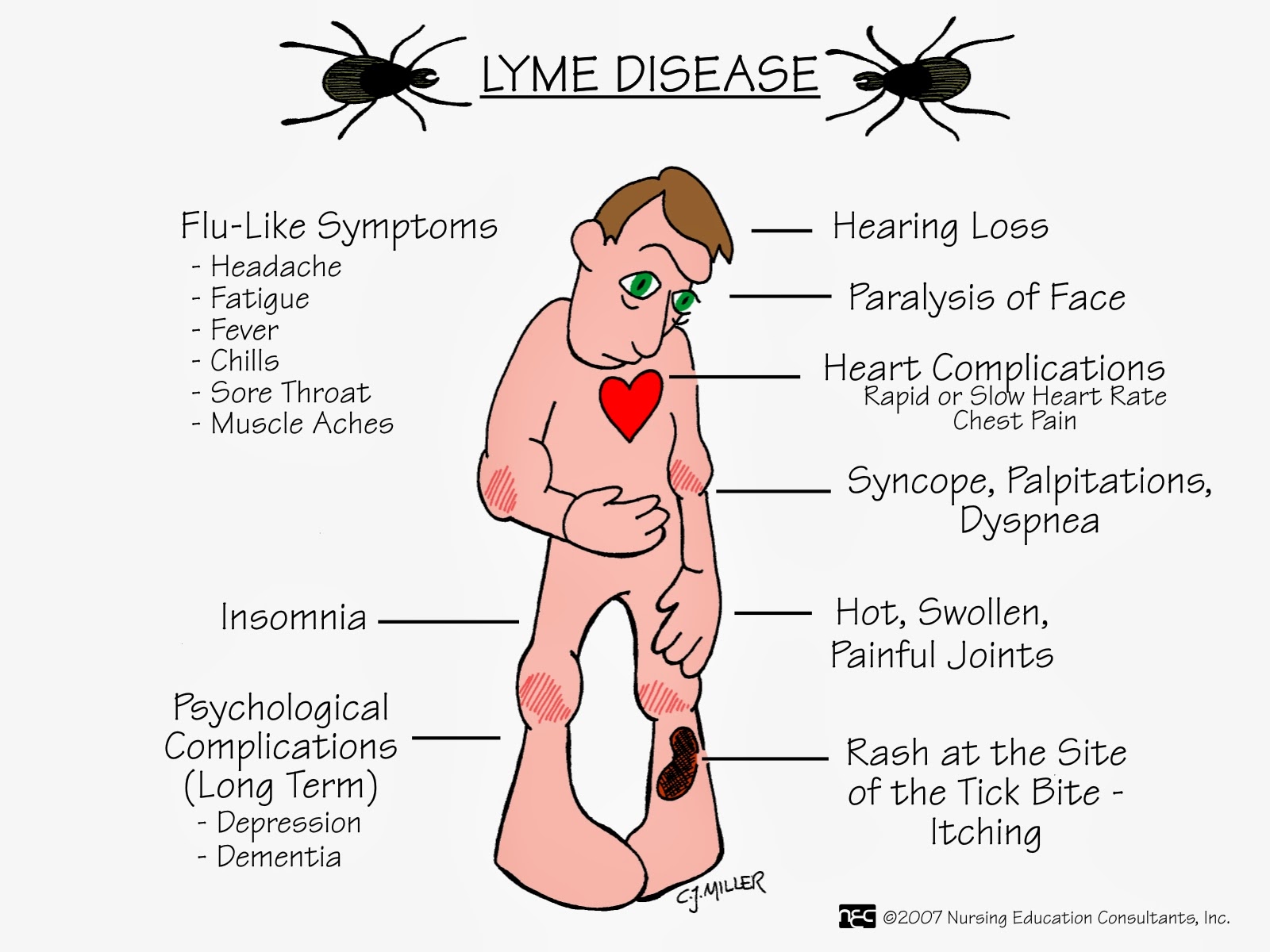 blog-Lyme-Disease-symptoms.jpg